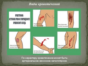 Презентация по ОБЖ,первая помощь при ранениях